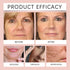 Collagen Wrapping Mask